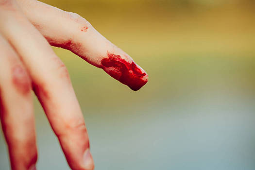 血,人,手指,手,手掌,伤口,受伤,出血,鲜明,红色,户外,模糊,散焦,绿色