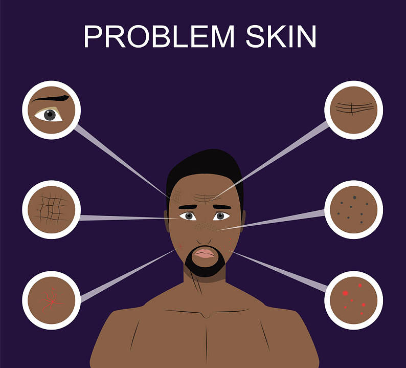 脸_护理_皮肤_问题_非洲式发型_男人_痤疮_皱纹_暗色_斑点_插画_化妆