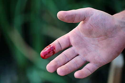 手指,伤口,特写,食指,右边,手,手掌,受伤,出血,鲜明,红色,血,户外