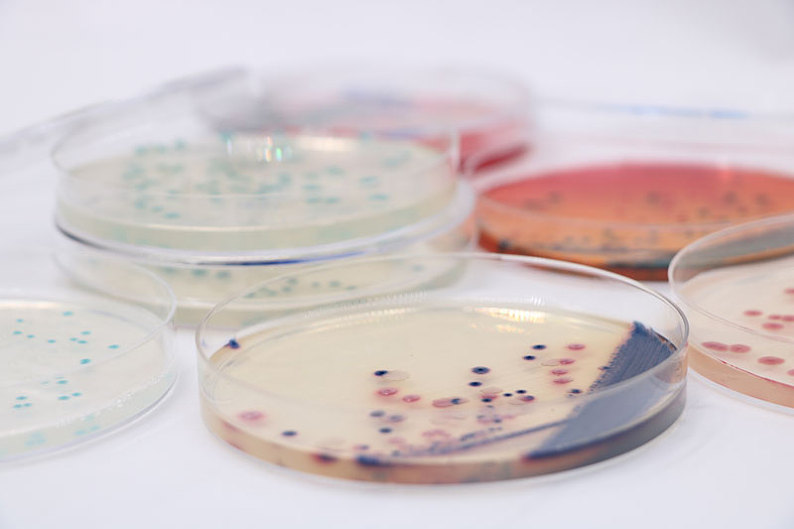 微生物细菌培养皿_高清图片_全景视觉
