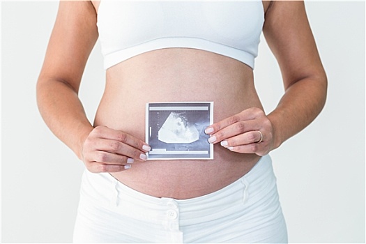 孕妇,展示,超声波扫描