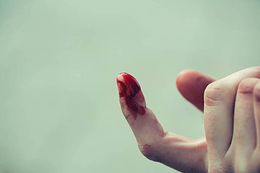 血,人,手指,手,手掌,伤口,受伤,出血,鲜明,红色,户外,模糊,散焦,绿色