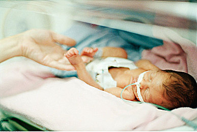 早产婴儿图片