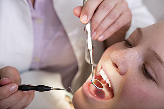 牙医,检查,牙齿