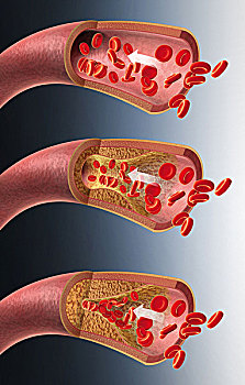 动脉,红血球