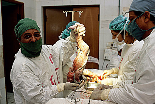外科,诞生,孩子,手术,女人,怀孕,复杂,公用,医院,卡拉奇,港口,城市,巴基斯坦,九月,2008年
