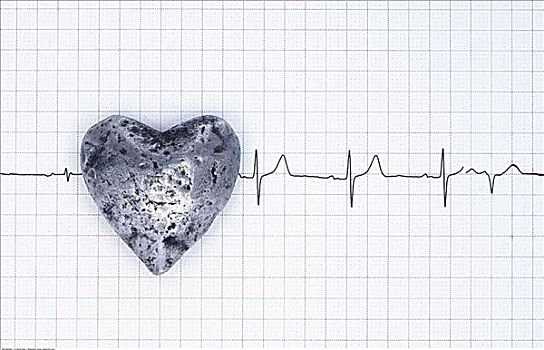 心脏,心电图,打印输出