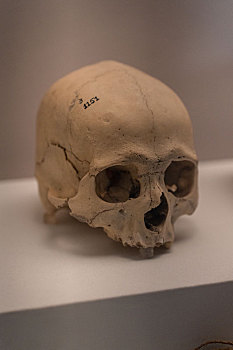 秘鲁印加博物馆印加帝国有钻孔痕迹的颅骨