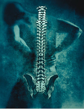 男人,脊髓,骨盆