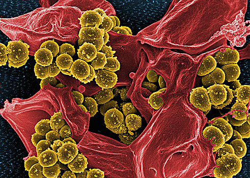 彩色,金黃色葡萄球菌,细菌,人,白细胞