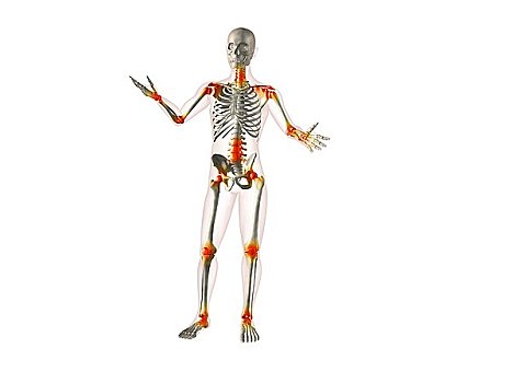 x光,人体骨骼,关节