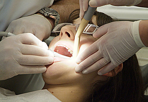 牙齿,外科