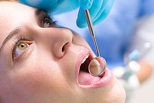 牙镜,病人,嘴,牙齿,反射