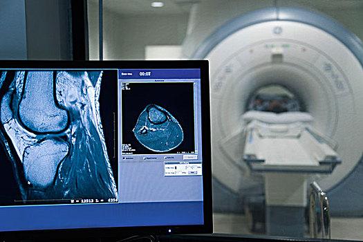核磁共振扫描,结果,电脑显示器