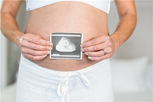 腹部,孕妇,拿着,超声波扫描图