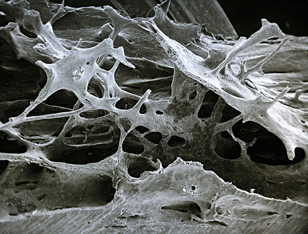 显微镜下的骨头图片