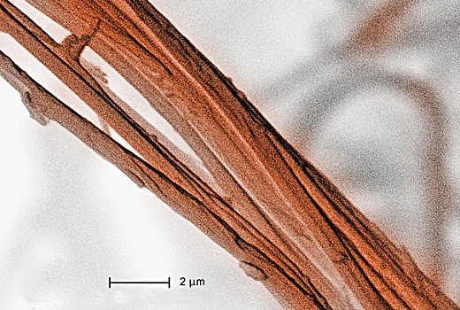 电子显微扫描图,石棉