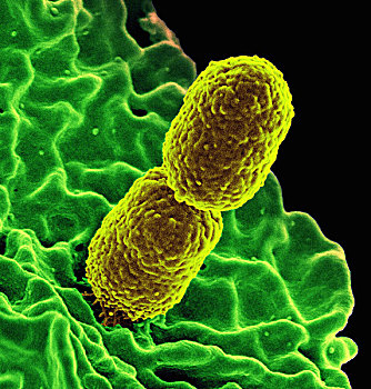 彩色,两个,细菌,黄色,互动,人,白细胞,绿色