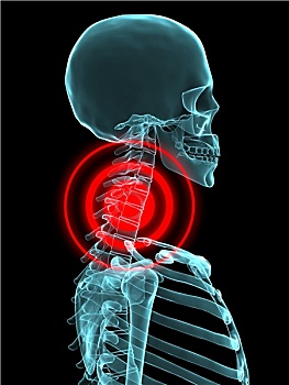 x光,突显,骨骼,颈部