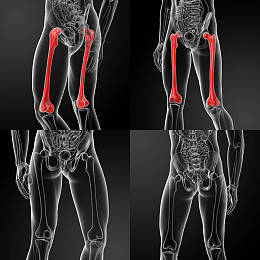 股骨图片