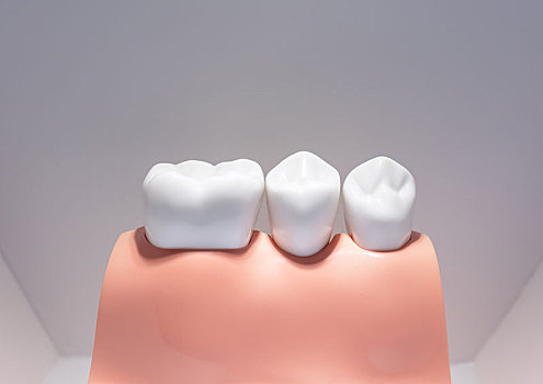 牙科医学模型