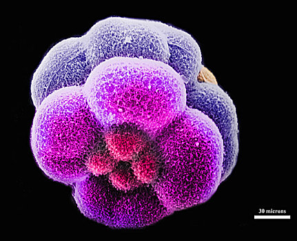 海胆,胚胎,细胞