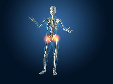 x光,人体骨骼,臀部,关节