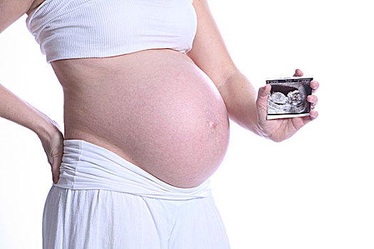 怀孕,妈妈,拿着,超声波,照片