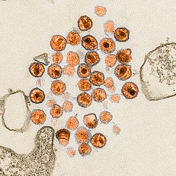 电子显微图,艾滋病毒,病毒