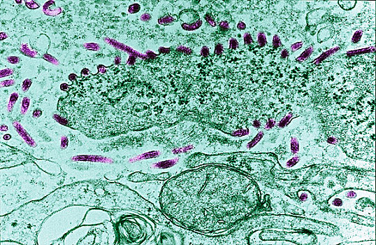 透射电子显微图,病毒