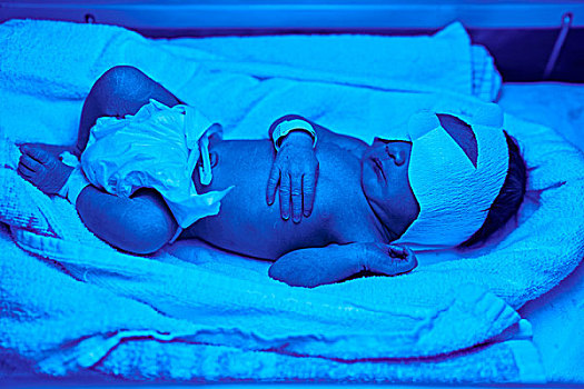 蓝光,治疗,婴儿