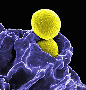 彩色,两个,球体,金黃色葡萄球菌,细菌,黄色,人,白细胞,蓝色