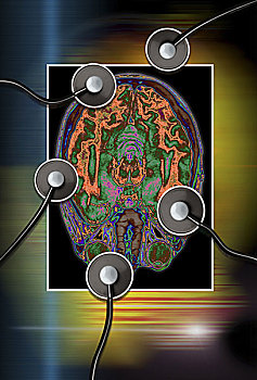 核磁共振成像,扫瞄,人,大脑