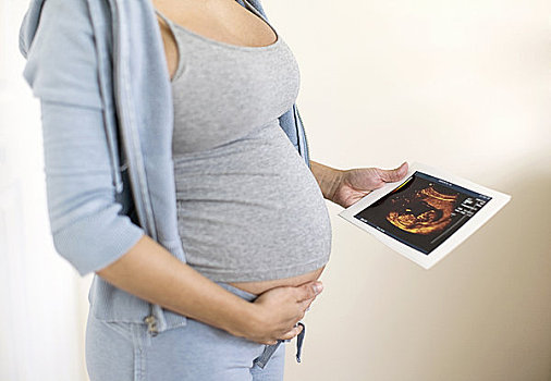 孕妇,拿着,超声波扫描图
