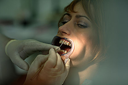 病人,牙套,合适