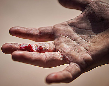 特写,脏,受伤,血,手指