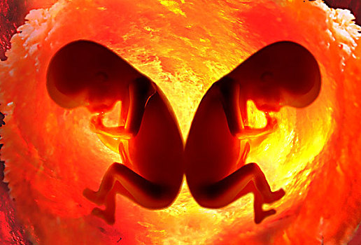 特写,相似,胎儿,子宫