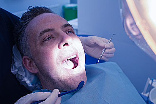 男人,牙齿,检查,牙医