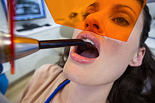 牙医,检查,女病人,牙齿,治愈,亮光,诊所