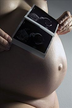孕妇,超声波,照片,婴儿