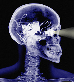 x光,骨骼,电子,眼,大脑