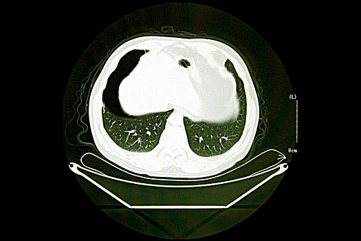 ct扫描断层影像图