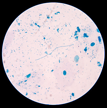 革兰染色阳性球菌图片