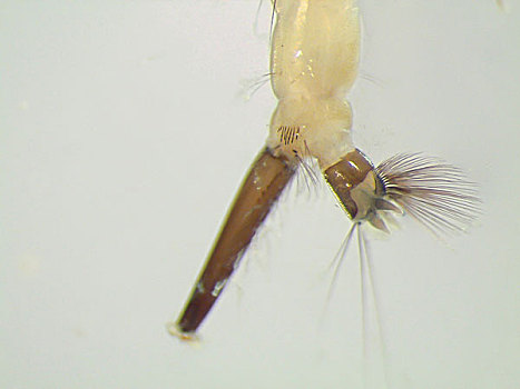 蚊子,幼体,显微镜