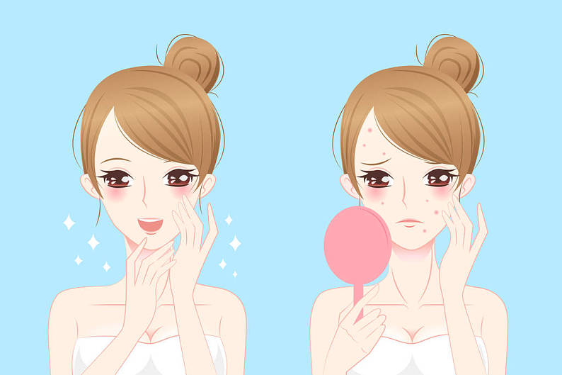 卡通_女人_痤疮_高清图片_全景视觉