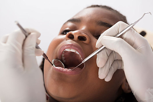 非洲人,女孩,牙医