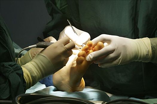 外科手术,脚