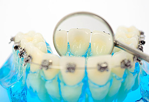 口腔卫生,假牙,固定,牙套,牙镜