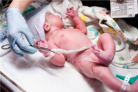 诞生,可爱,婴儿,脐带