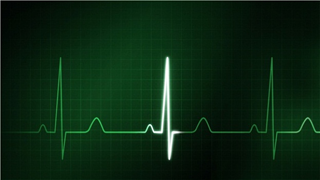 绿色,心电图,显示器,医疗